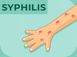 সিফিলিস কী? কারণ, লক্ষণ, চিকিৎসা ও প্রতিরোধ