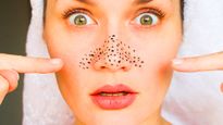 Blackheads Removal: ব্ল্যাকহেডসে ভরে যাচ্ছে নাক, থুতনি? টি ট্রি অয়েলের গুণেই দূর হবে সমস্যা