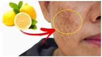 লেবু দিয়েই করুন ত্বকের পরিচর্যা, দূর হবে কালচে দাগছোপ, ফিরবে জেল্লা!
