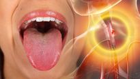 গার্গল করেও গলা ব্যথা কমছে না? হতে পারে ক্যানসারের ইঙ্গিত, কোন লক্ষণ দেখে সাবধান হবেন?