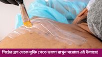গরমে পিঠ ভর্তি ব্রণর সমস্যা, নিস্তার পান ঘরোয়া প্রতিকারেই