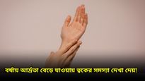 স্যাঁতস্যাঁতে বর্ষাতেও মসৃণ-উজ্জ্বল ত্বক ধরে রাখুন সহজ এই কয়েকটি উপায়ে! 