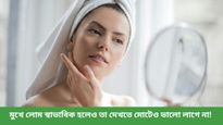 মুখের অবাঞ্ছিত লোম অস্বস্তি বাড়িয়ে তুলেছে, সমস্যা এড়াতে আজই ট্রাই করুন এই ঘরোয়া প্রতিকার    