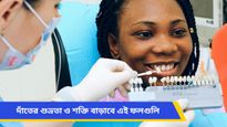 দাঁতের হলদেভাব কাটছেই না, হাজার চেষ্টাও বিফলে? দাঁত ঝকঝকে ও সুন্দর করে তুলতে মেনে চলুন এই টিপস!