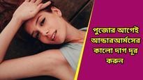 আন্ডারআর্মের বিশ্রী কালো দাগ নিয়ে চিন্তিত? এই ঘরোয়া উপায় মেনে চললে মিটবে সমস্যা 
