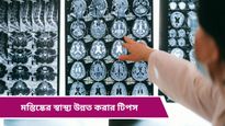 Brain Health: বয়সের থাবা পড়ে মস্তিষ্কেও, কীভাবে সুস্থ রাখবেন জেনে নিন বিশেষজ্ঞদের মত 
