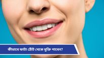  Chapped lips: শীতে ঠোঁট শুকিয়ে ফেটে রক্ত বের হচ্ছে? রইল খুবই সাধারণ কিছু ঘরোয়া টোটকা!   