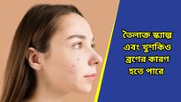  Acne: শীতে মুখে ব্রণর সমস্যায় জেরবার, নেপথ্য কি রয়েছে খুশকি? জানুন বিশেষজ্ঞদের পরামর্শ  
