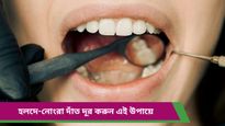 Dental care: সামনেই বিয়ে, কিন্তু হলদে-নোংরা দাঁত নিয়ে চিন্তা? ভরসা রাখুন ঘরোয়া উপায়ে 