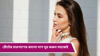 Hyperpigmentation: ঠোঁটের চারপাশে কালচে ছোপ অস্বস্তি বাড়াচ্ছে? কীভাবে প্রতিরোধ করবেন জানুন