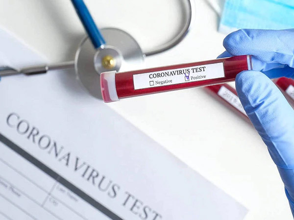 ICMR revises RT-PCR testing guidelines