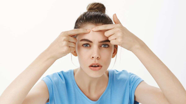 Home Remedies For Forehead Acne