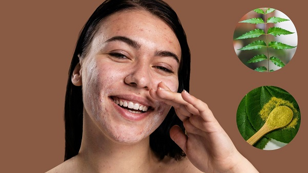 Neem Face Packs