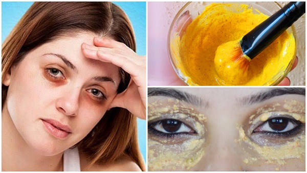 Natural Remedies for Dark Circles Natural Remedies for Dark Circles