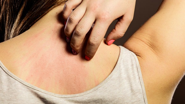 skin infections you can get from not changing bedsheets