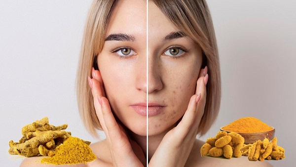 Turmeric Face Pack