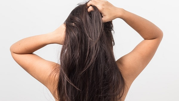 dry scalp