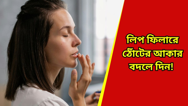 Lip-fillers1