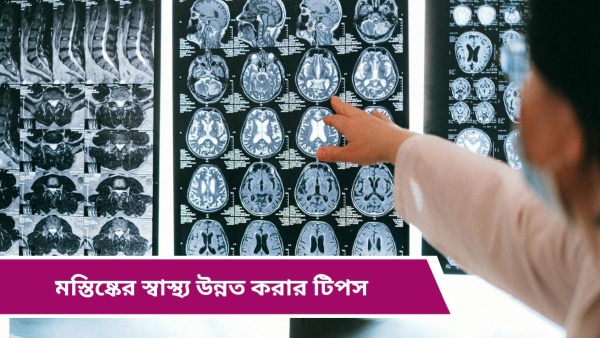 brain brain