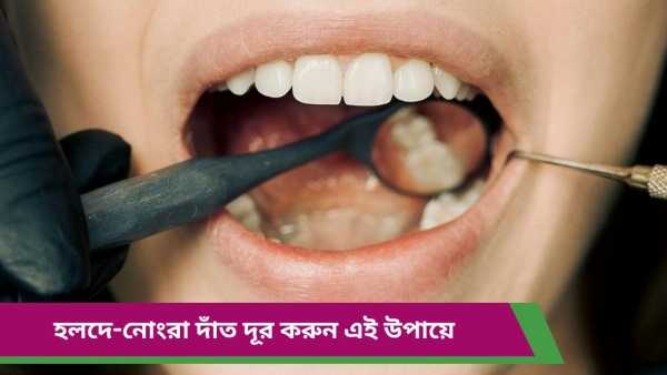 dirty teeth dirty teeth