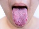 Harmful Things That Happen When You Do Not Brush Your Tongue!
