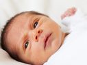 How To Deal With Cradle Cap In Babies