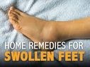 12 Effective Home Remedies For Swollen Feet