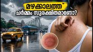 മഴക്കാലത്ത് ചർമ്മം ചൊറിഞ്ഞു തടിക്കുന്നുണ്ടോ? ഈ ലളിതമായ കാര്യങ്ങൾ ശ്രദ്ധിച്ചാൽ മതി!