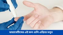 ডায়াবেটিসের সমস্যা থাকলে ভুলেও ছোঁবেন না আঙ্গুর-কলা, হতে পারে মারাত্মক সমস্যা!