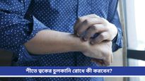 Itching: বারবার লোশন লাগিয়েও চুলকানি কমছে না? ঘরোয়া টোটকাতেই পাবেন মুহূর্তে আরাম!