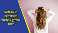Hair Care: খুশকির সমস্যায় জেরবার? নামী-দামি শ্যাম্পু না, এই খাবারগুলিই দেবে মুক্তি