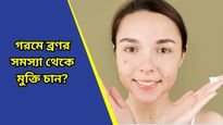 Skin care: ব্রণর সমস্যায় জেরবার? এই ঘরোয়া প্যাকের ম্যাজিকেই হবে সমস্যার সমাধান