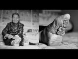 फुट बाइंडिंग: सेक्‍स और सुंदरता के लिए चाइनीज महिलाओं के पैरो का होता था ये हश्र