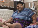दिल्‍ली के 237 Kg वजन के सबसे वजनी लड़के का डॉक्टरों ने सर्जरी से 7 महीनें में घटाया 60 Kg