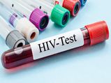 HIV पर हुई बड़ी खोज, मालूम चला कैसे शरीर में फैलता है ये खतरनाक वायरस