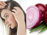 सिल्की और घने बालों के लिए प्याज का रस है असरदार, जानें लगाने का तरीका 