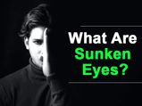 Sunken Eyes : क्या आपकी आंखें धंसने लगी हैं, तो जानिए इसके कारण और कैसे कर सकते है इसका इलाज 