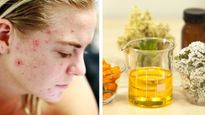 जोजोबा ऑयल से मिलेगी खिली- खिली त्वचा