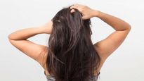 Home Remedies For Greasy Hair: चिपचिपे और ऑयली बालों से हो गए परेशान, बस इन उपायों से पाएं छुटकारा
