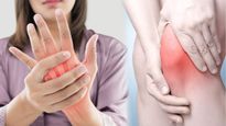 World Arthritis Day 2023: अर्थराइटिस से जुड़े 6 Myths जिनके Facts आपको मालूम होने चाह‍िए