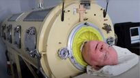 72 साल तक लोहे के फेफड़ों से सांस लेते रहे Paul Alexander, क्‍या होता है Iron Lungs और कैसे करता है काम