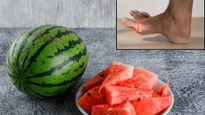 Watermelon in Uric Acid : तरबूज खाने से यूरिक एसिड बढ़ता है या घटता, जानें खाएं या न खाएं?