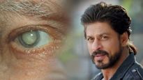 Shahrukh Khan Eye Problem: आंखों की इस बीमारी से जूझ रहे हैं शाहरुख खान, 50 के बाद होने का ज्यादा खतरा