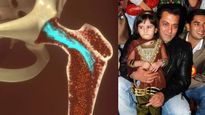 Bone Marrow डोनेट करने वाले पहले एक्‍टर हैं सलमान खान, जानें कब पड़ती है जरुरत