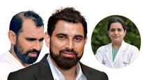 क्यों कम उम्र में गंजे हो जाते हैं मर्द? मोहम्मद शमी का ट्रांसप्लांट करने वाली डॉक्टर ने बताई वजह