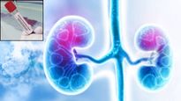 Kidney Function Test: खराब होने से पहले ही किडनी की सेहत का हाल बता देगा ये 'टेस्ट', साल में 1 बार जरूर कराए