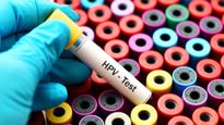 HPV Testing Kits : एम्‍स ने लॉन्‍च की एचपीवी टेस्ट किट, सात तरह के कैंसर की होगी आसानी पहचान