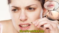 बॉडी से अनचाहे बालों से हैं परेशान? बिना दर्द के और पैसे खर्च किए इन 5 तरीकों से चिकनी स्किन