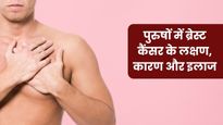 पुरुषों को भी हो सकता है ब्रेस्ट कैंसर, जानें इसके लक्षण, कारण और इलाज के बारे में