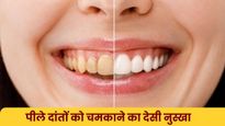 डॉक्टर रोबिन शर्मा ने बताया पीले दांतों को घर पर चमकाने का देसी नुस्खा, आपकी रसोई में है मौजूद